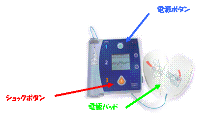 ブルーグレーと紺色のAED本体の上に青地で「電源ボタン」、左下に赤色で「ショックボタン」と書かれた文字と、白い心電図電極パッドに黄緑色で「電極パッド」と書かれた写真