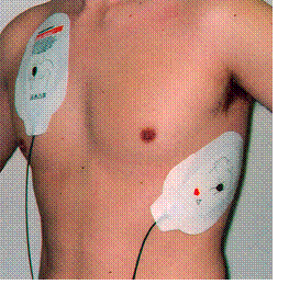 裸の男性の上半身の右胸と左脇に電極パッドが貼られている写真